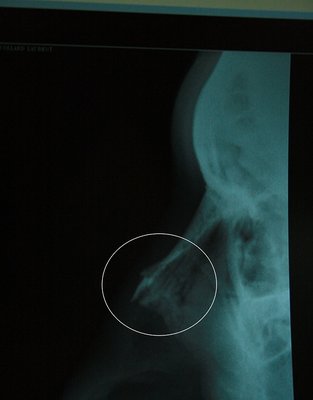 entuffage du nez